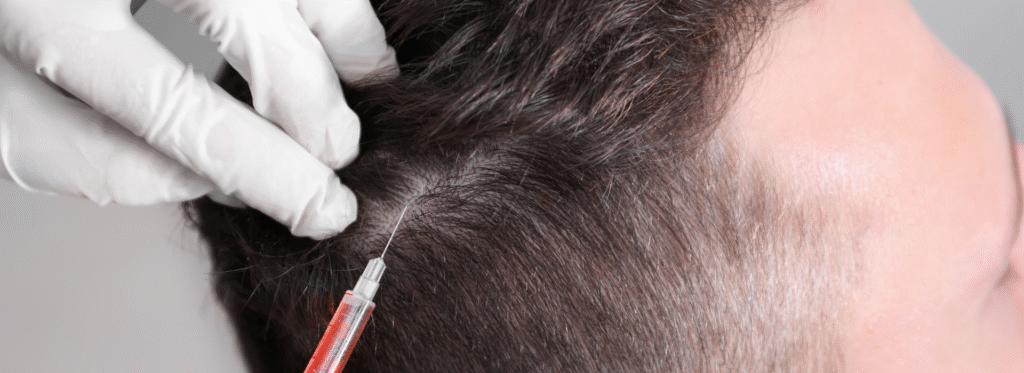 Best hair treatment clinic in Bangalore